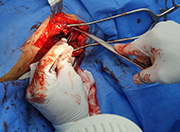 Herida pierna cirujano toro uvi urgencia